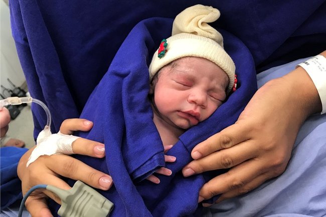 This Dec. 15, 2017 photo provided by transplant surgeon Dr. Wellington Andraus shows the baby girl born to a woman with a uterus transplanted from a deceased donor at the Hospital das Clinicas of the University of Sao Paulo School of Medicine, Sao Paulo, Brazil, on the day of her birth. Nearly a year later, mother and baby are both healthy. [File photo: AP]