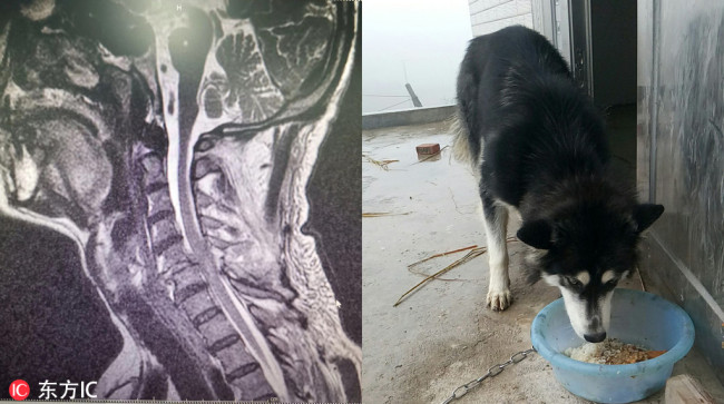 The X-ray of the dog owner's neck and the Husky responsible for the injury. [Photo: IC]