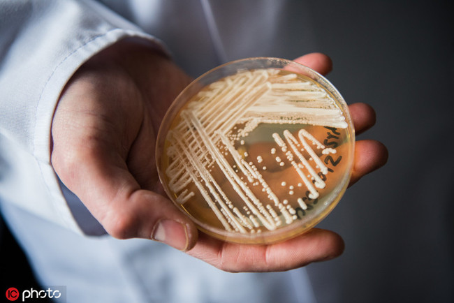 Oliver Kurzai, the director of the National Reference Centre for Invasive Fungus Infections, holds a petri dish containing a culture of Candida auris at Wuerzburg University in Germany on January 23, 2018. [File Photo: IC]